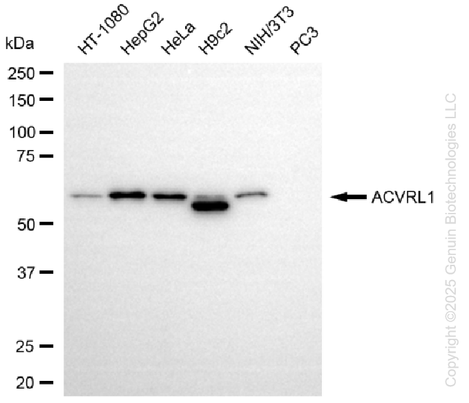 WB - KD-Validated Anti-Activin A Receptor Like Type 1 Rabbit Monoclonal Antibody AGI1331